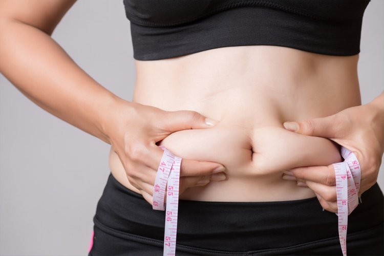 Life After Liposuction Health Strategies from Best Liposuction Surgeon in Dubai