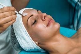 Benefits of Chemical Peel in Edmonton