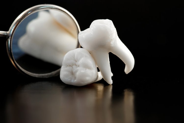 Dental Partials: A Comprehensive Guide to Replacing Missing Teeth