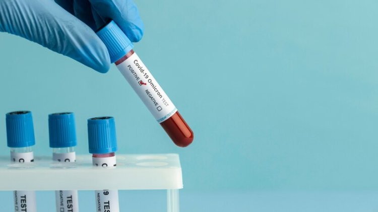 How Long Do I Need To Fast Before A Blood Test?