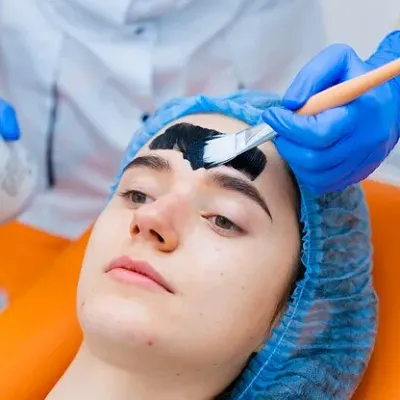 Can Laser Carbon Peel Give You a More Refined Complexion?