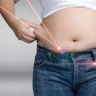 Laser Liposuction Versus Traditional Methods for Smoother Body Contouring