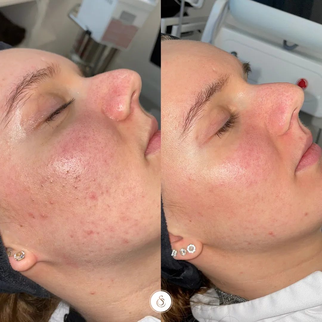How a Menopause Skin Treatment Clinic Supports Healthy Skin
