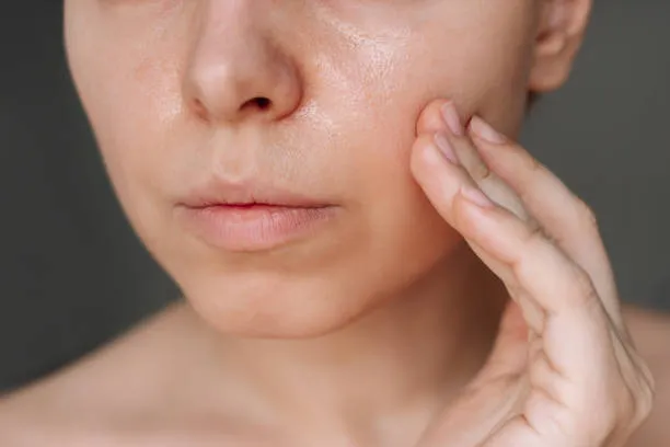 Which Open Pores Treatment Works Best? Expert-Backed Options for Smoother, Clearer Skin